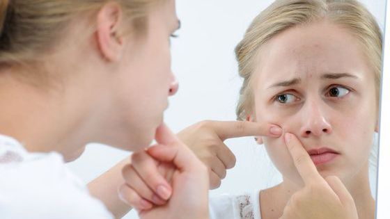 Trądzik kosmetyczny bywa trudny do zwalczenia