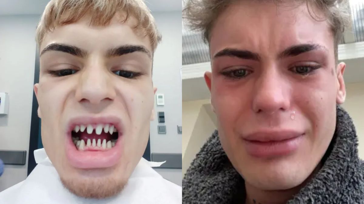 Jack James poznał przykre konsekwencje tureckiej metamorfozy