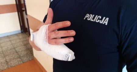 Hannibal Lecter z opla corsy. Policjant bez palca