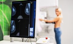 "Nic nie boli" to pułapka, w którą wpada większość Polaków. Jak przejść przez profilaktykę onkologiczną z planem i bez stresu