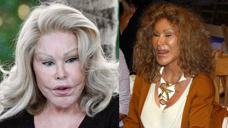 "Kobieta Kot" twierdzi, że nie przeszła żadnej operacji plastycznej