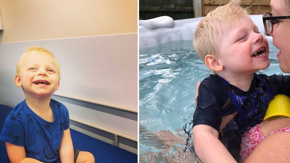 Ataki smiechu i nietypowa mimika to efekt zespołu Angelmana 