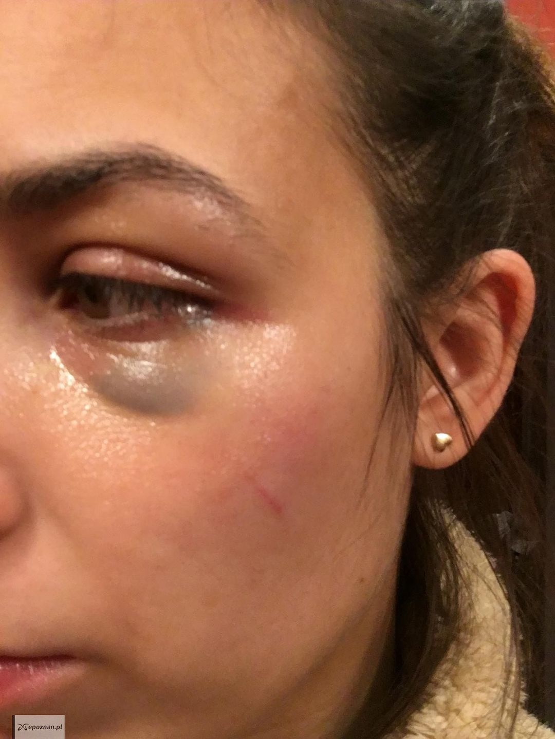 Kobieta pobita przez właściciela agresywnego psa