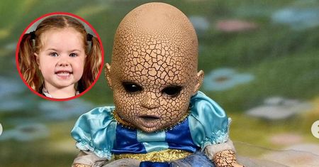 Są nierozłączne, matka była przerażona. "Wygląda jak z horroru"