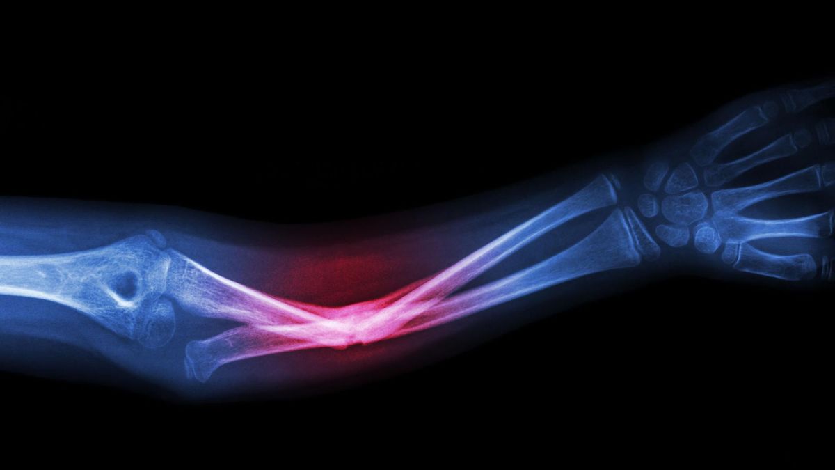 Przedramię jest angażowane do większości ćwiczeń składających się na trening siłowy