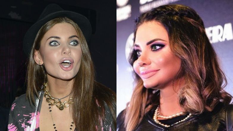 Wodzianka staje w obronie swoich dorodnych policzków