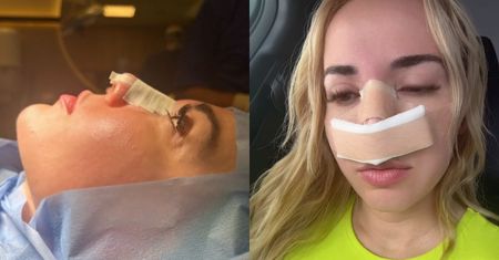 Marianna Schreiber nadaje z auta świeżo po KOREKCIE NOSA. "Stara Marianna, NOWY nos" (FOTO)