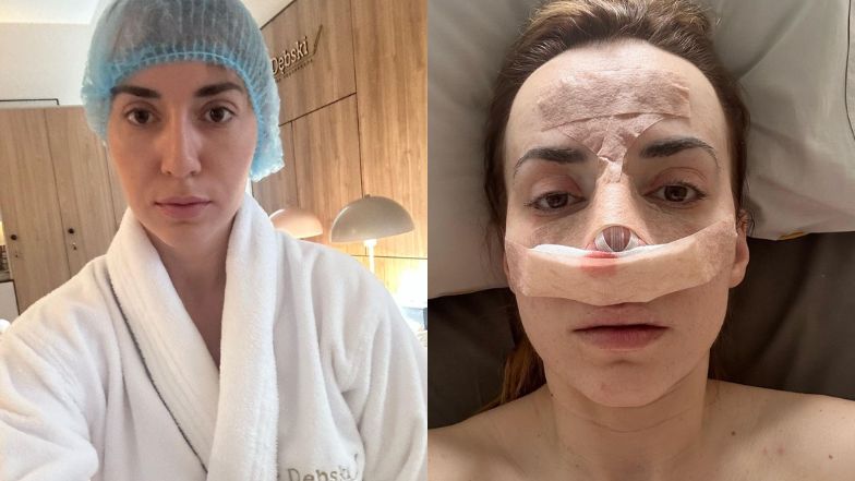 Marianna Schreiber przeszła operację plastyczną. "Czekałam 15 lat"