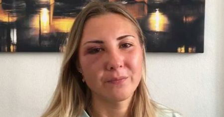 22-latka uderzona w twarz na ulicy. Powód? Spódnica. Burza we Francji