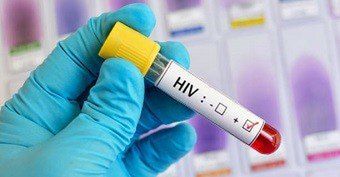 Zdrowie: Bezpłatne i anonimowe badania HIV w Kaliszu