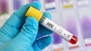 W Kaliszu można wykonać bezpłatne badania na obecność wirusa HIV