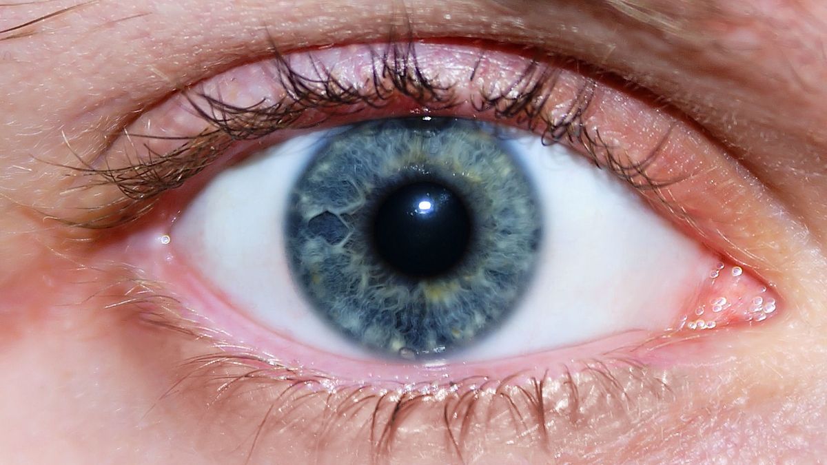 Pan Adam odzyskał wzrok