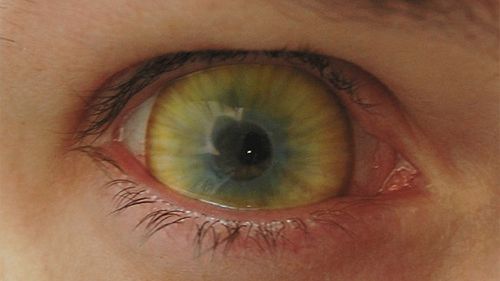 40 najdziwniejszych soczewek kontaktowych 1