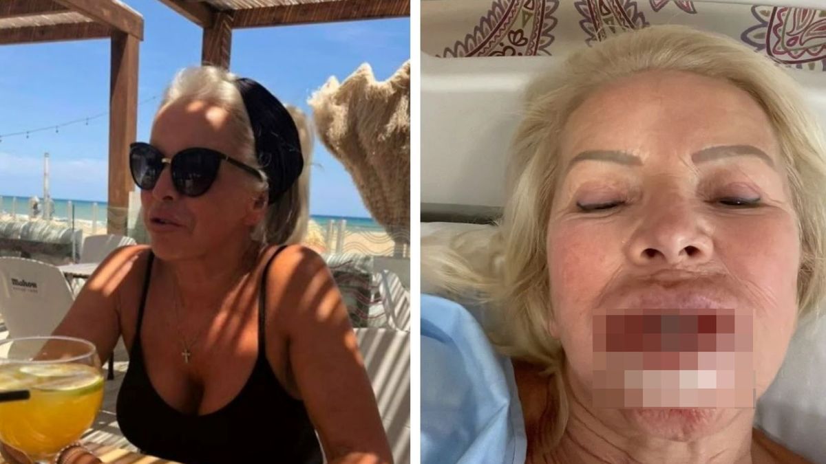 64-latka podzieliła się swoją historią 