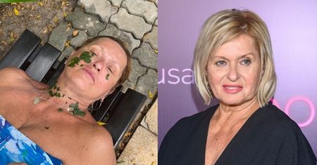 Ewa Kasprzyk została poparzona przez meduzę! "Czy będę jeszcze mogła grać tą twarzą?" (FOTO)