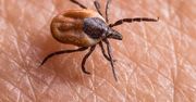 Kleszcz nawet się nie zbliży. Wystarczy, że posmarujesz tym skórę