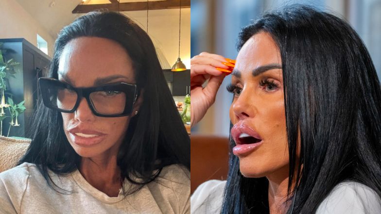 Katie Price poddała się kolejnym zabiegom upiększającym 