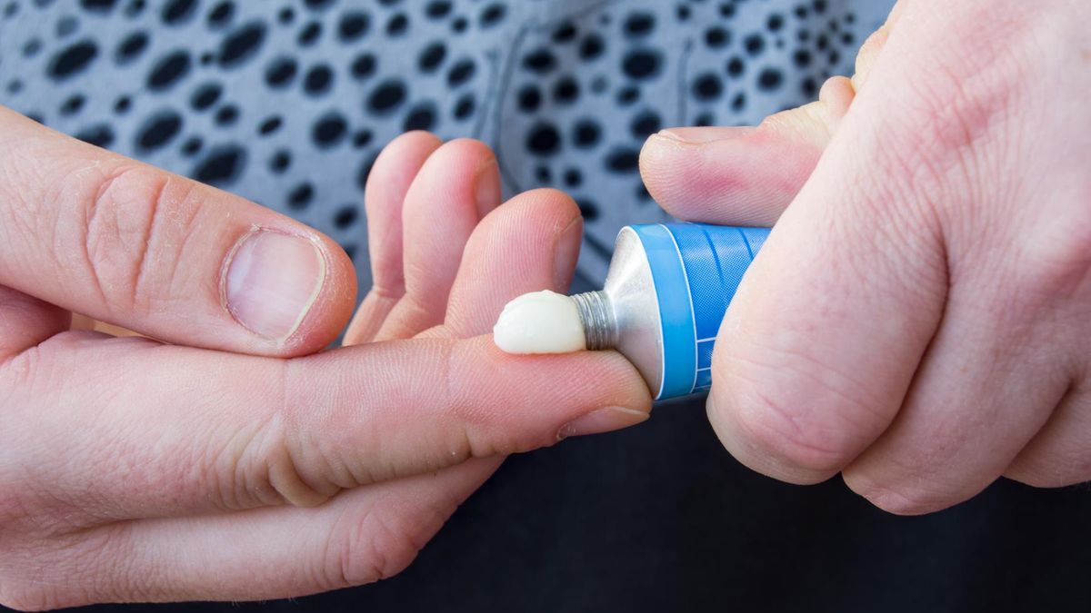 Hydrokortyzon może być stosowany miejscowo, ogólnoustrojowo oraz dożylnie