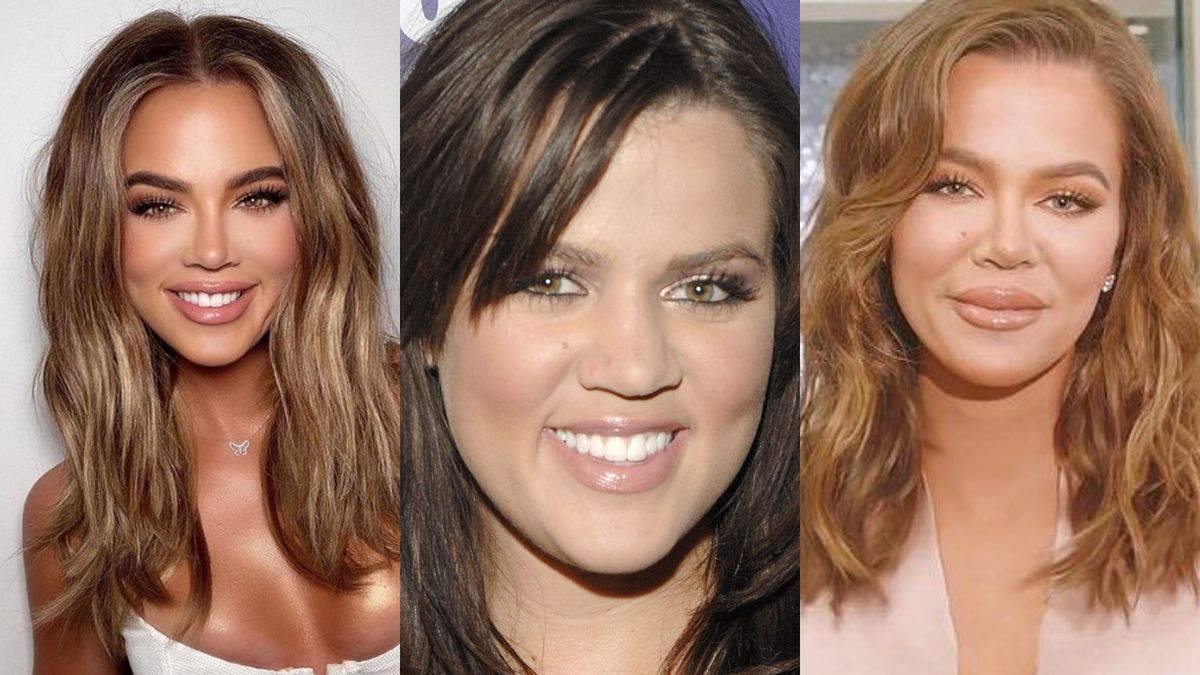 Khloe Kardashian twierdzi, że "miała tylko jedną operację". Zgadniecie jaką?