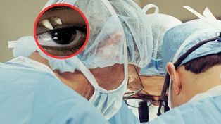 Zgłosił się do szpitala z obrzękiem powieki. W oczodole znaleźli ząb