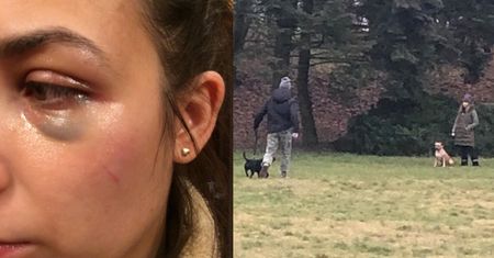 Znany raper UDERZYŁ W TWARZ kobietę?! Za to, że broniła swojego szczeniaka przed jego agresywnym pitbullem...
