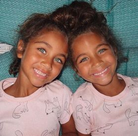 Najpiękniejsze bliźniaczki na świecie? Ludzie oszaleli na ich punkcie