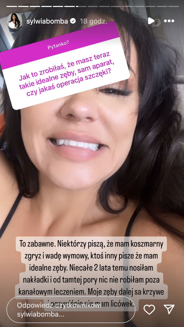 Sylwia Bomba szerzej opowiedziała o swoich zębach