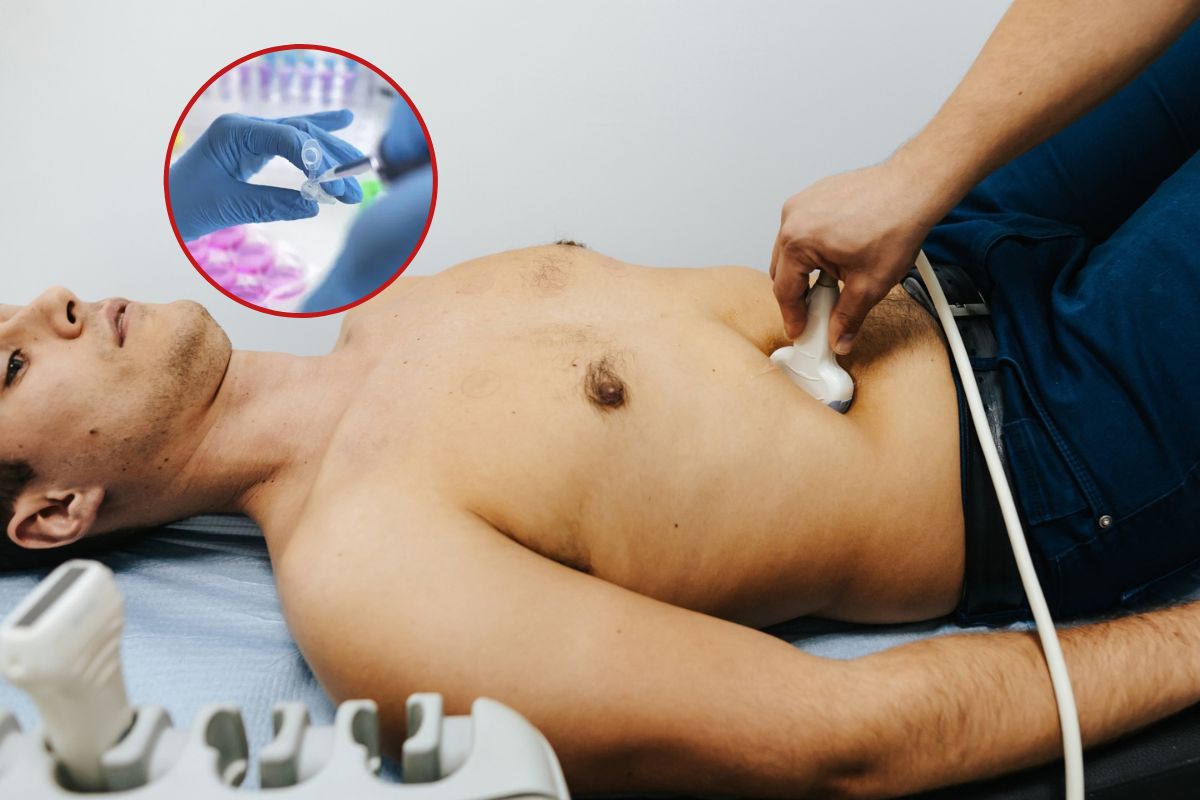 Opracowali "miniwątroby". Nowa technologia może zastąpić przeszczep