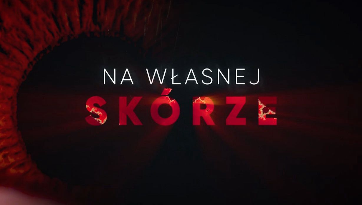 "Na własnej skórze"