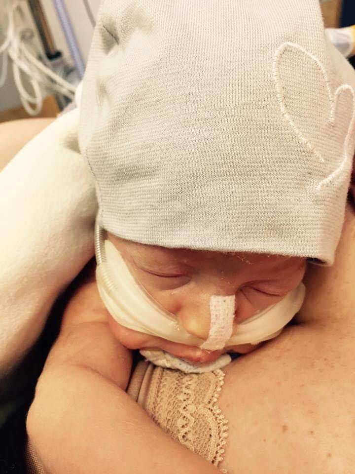 Maszyny podtrzymywały funkcje życiowe malucha