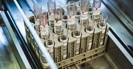 Szczepionka na COVID. Mamy nowe informacje od firmy Pfizer