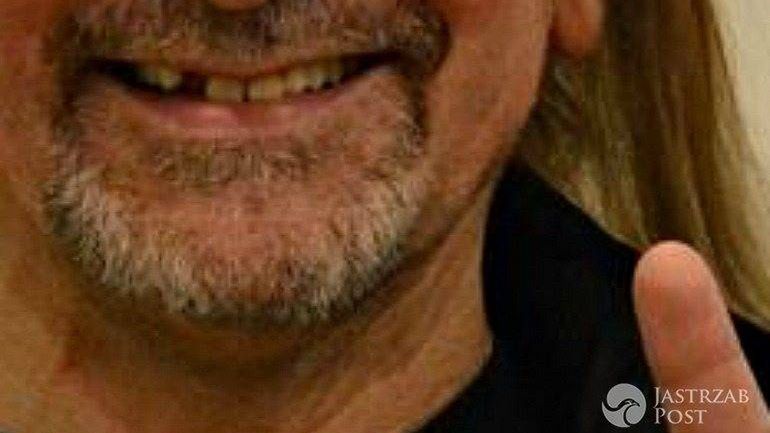 Marek Piekarczyk stracił zęba