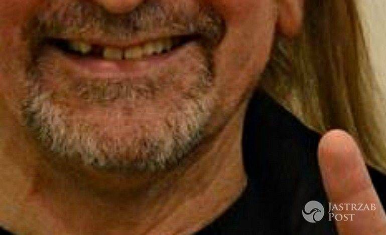 "Sylwester 2015. Bez dwójki". Kto stracił zęba tuż przed nowym rokiem?