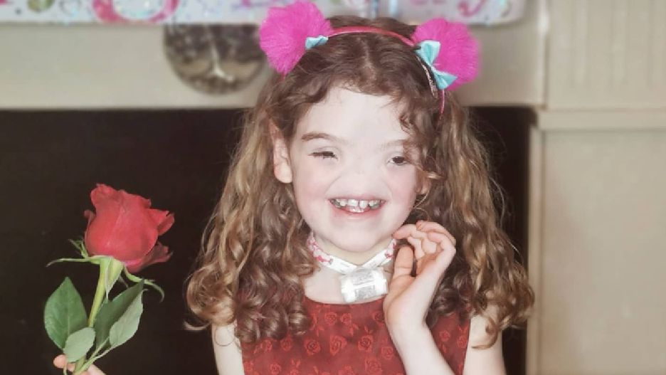 Urodziła się bez nosa. Tak wygląda jako 11-latka