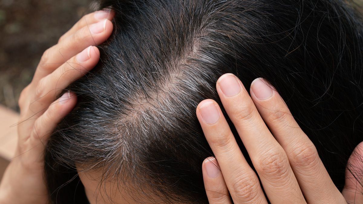 Naturalne sposoby na pozbycie się siwych włosów 