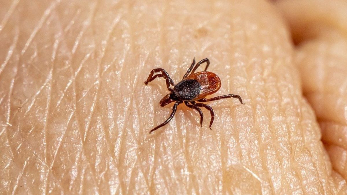 Mężczyzna po ugryzieniu kleszcza zmarł na gorączkę krymsko-kong