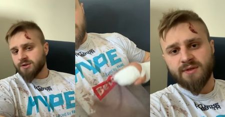 Gwiazdor Fame MMA zaatakowany MACZETAMI we własnym domu: "Przyszli tylko w jednym celu. Było nim morderstwo"