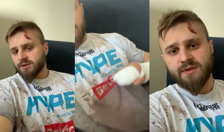 Gwiazdor Fame MMA został napadnięty we własnym domu?!