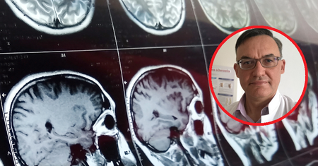 Zabijają lub odbierają sprawność. 5 chorób, które mogą zostać błędnie zdiagnozowane