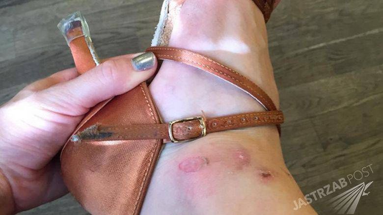 Noga Eweliny Lisowskiej