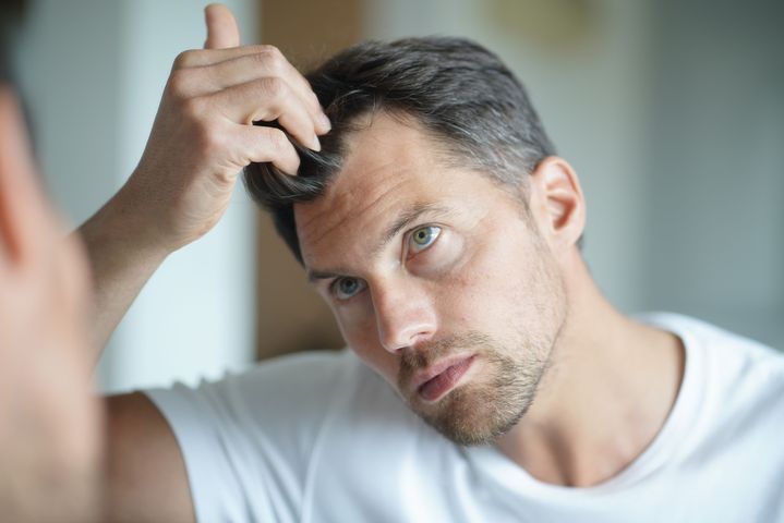 Piloxidil to płyn na skórę, który hamuje wypadanie włosów.