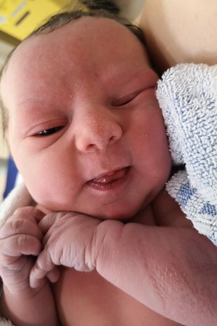 Grymas na twarzy noworodka szybko znikł