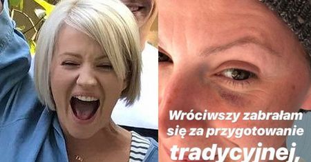 Dorota Szelągowska pozuje z PODBITYM OKIEM: "Warmia niczym Mielno zniszczy każdego" (FOTO)
