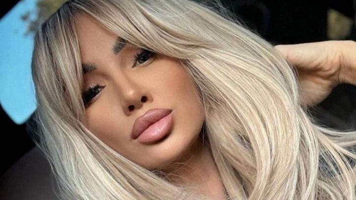 Izabela Macudzińska pokazała się bez doczepów