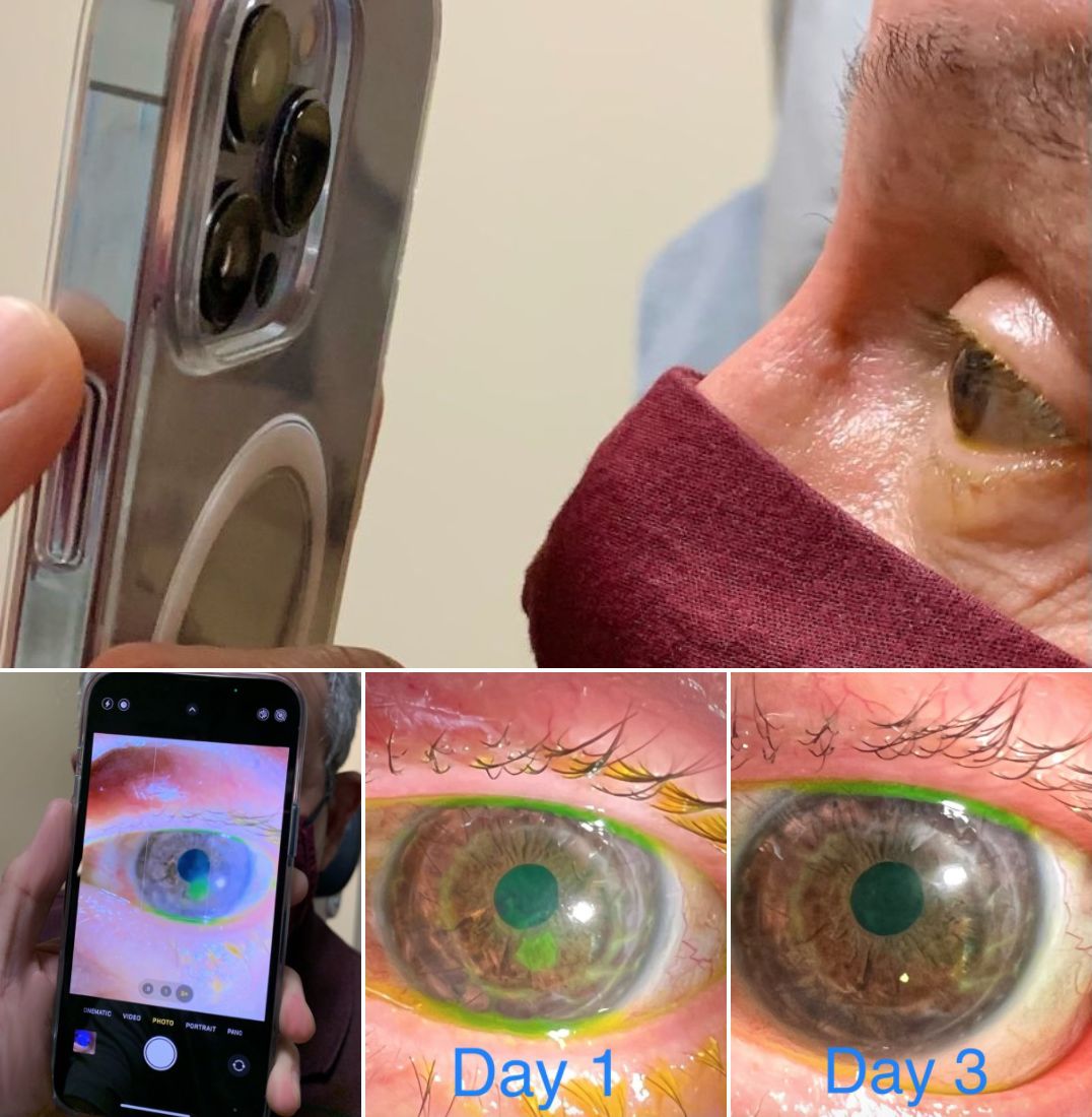 Lekarz zachwycony iPhone'em 13 Pro. Powód? Nowy aparat 2