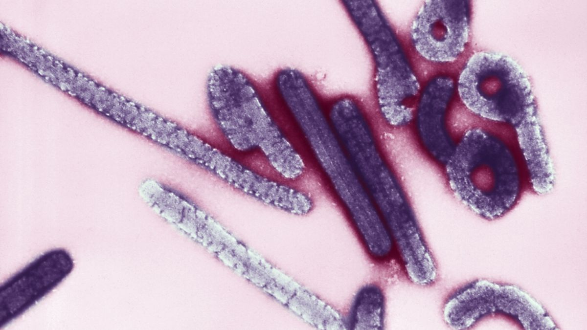 Wirus Ebola.
