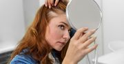Babciny patent powstrzyma wypadanie włosów. Wystarczy jeden produkt z kuchni