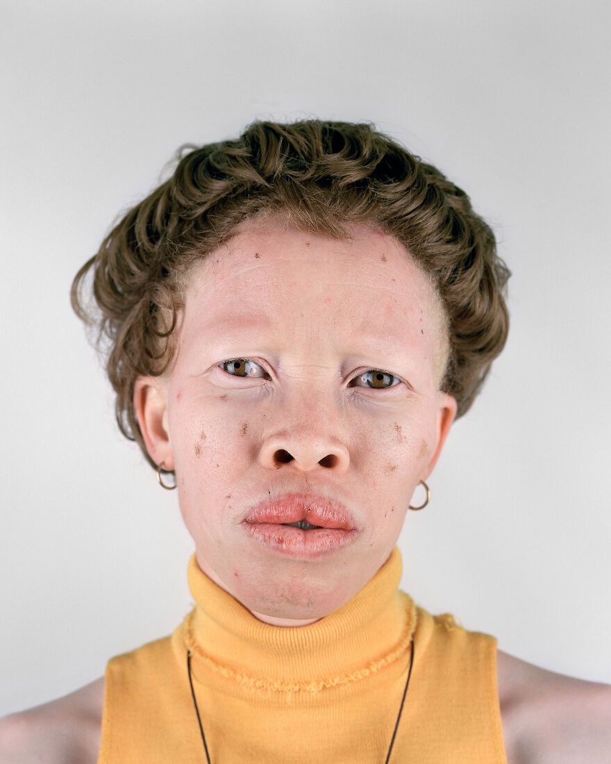Pieter Hugo pokazuje życie ludzi zepchniętych na margines w Afryce. Te zdjęcia poruszają 6