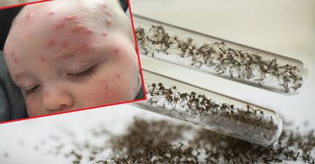 Dla dzieci ukąszenia komarów mogą być groźne. Tych objawów nie bagatelizuj