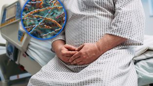 Bakteria, która odchudza? Turicibacter może być przełomem w walce z otyłością